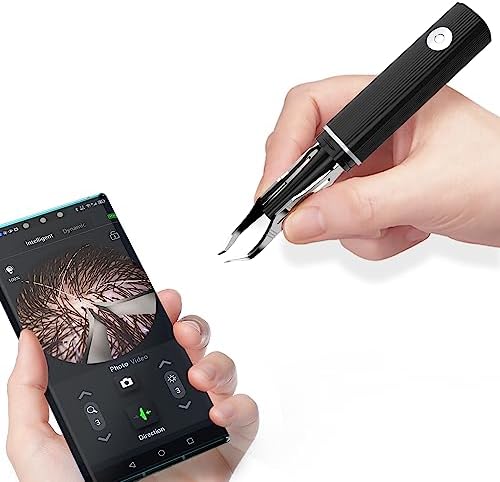 Hair Removal Tweezer with 1080p Camera, Ultimate Precision: Tweezer with Camera - Perfect for Delicate Tasks!